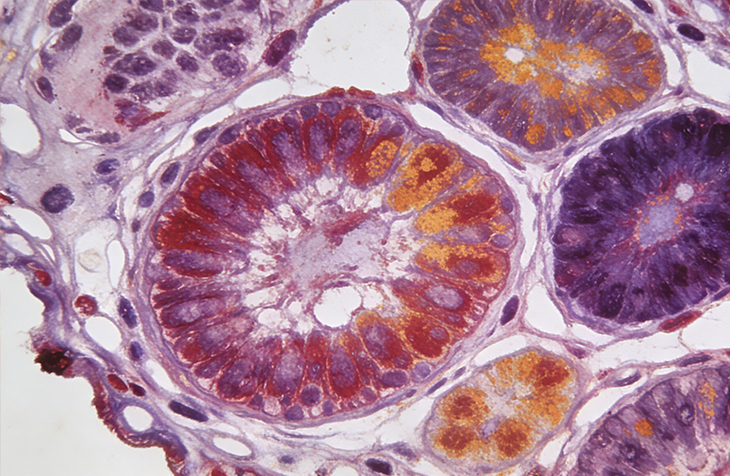 免疫组化（IHC）/免疫荧光