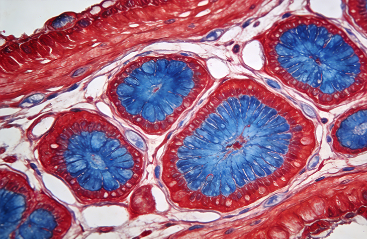 苏木精-伊红染色（HE染色）